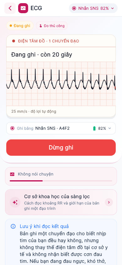 Recording an ECG