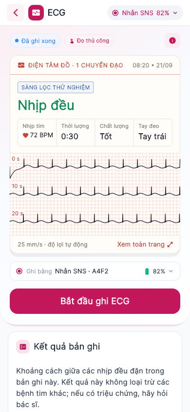 ECG result